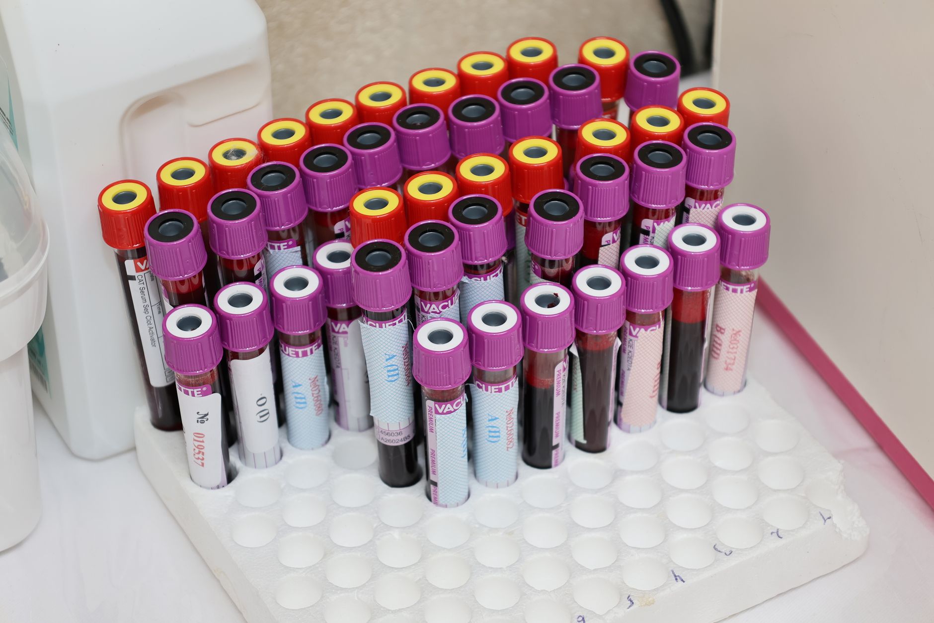 Lp(a): The Inherited Heart Risk You've Probably Never Been Tested For